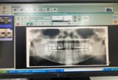 Panoramic x-ray with ceph