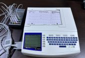 ECG