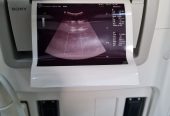 Ultrasound