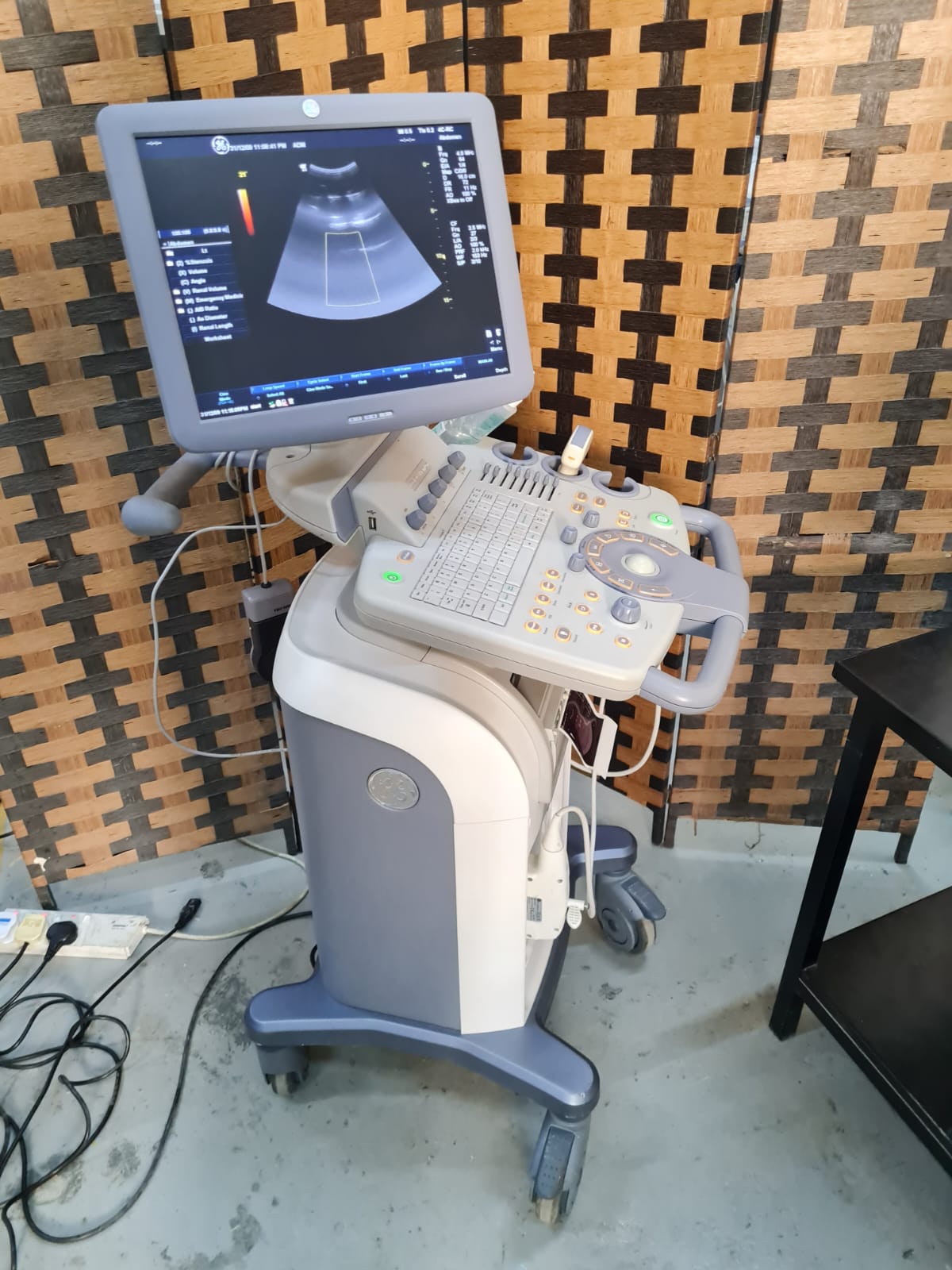 Ultrasound