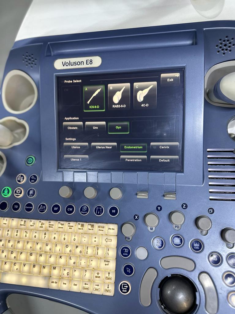 GE Ultrasound